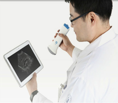 Wireless Ultrasound